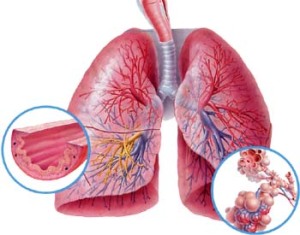 Fysiotherapie bij COPD